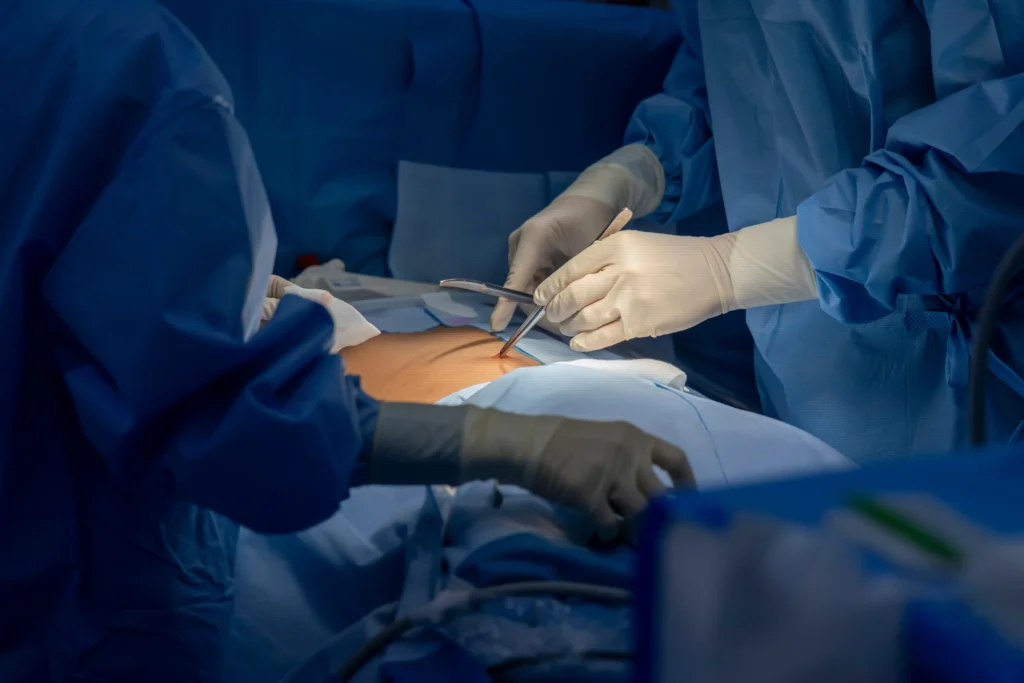 photo of doctors performing surgery